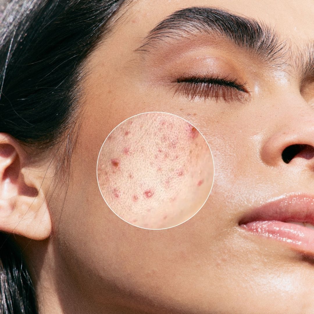 Exfoliant AHA + BHA 30 ml